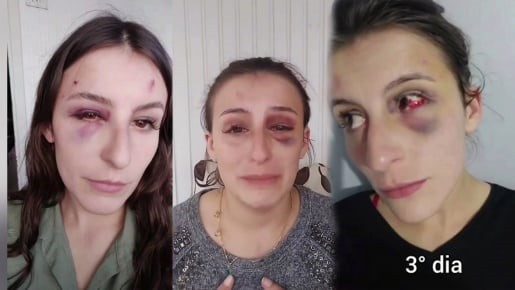 Maquiadora usa redes sociais para denunciar agressões do namorado em SMO