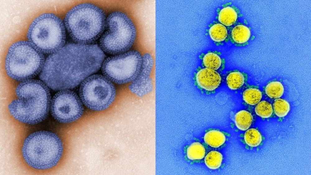 Flurona: entenda o caso de dupla infecção de Covid-19 e gripe em Israel