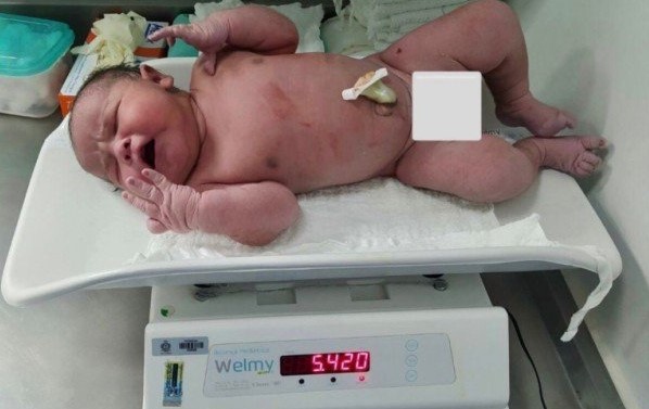 Bebê nasce com quase cinco quilos e meio no hospital de São Miguel do Oeste