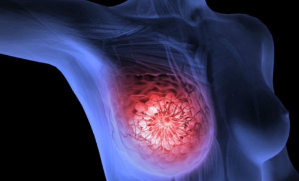 SC apresenta queda de 24% na realização de exames de mamografia pelo SUS