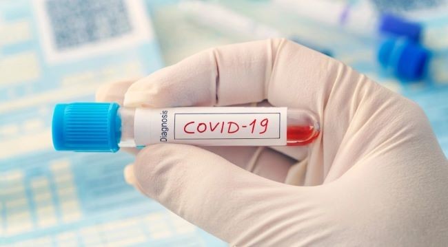 Fiocruz alerta para aumento de casos de Covid-19 em 12 estados brasileiros