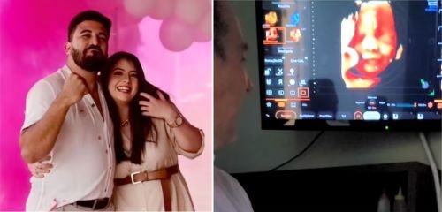 Bebê reage à voz do pai e sorri durante ultrassom no Oeste de SC