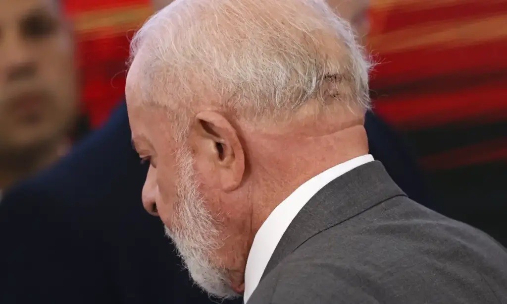 Lula passará por nova cirurgia na cabeça nesta quinta-feira