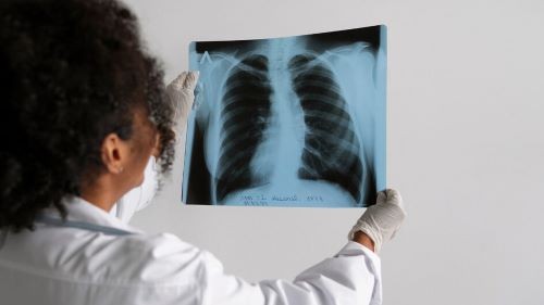 SC registrou mais de 2,3 mil casos de tuberculose em 2024