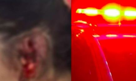 Marido arranca pedaço da orelha da esposa durante briga por ciúmes