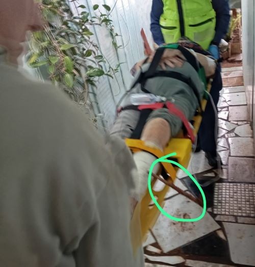 Idosa de 86 anos sofre queda e tem perna transfixada por vergalhão no Oeste
