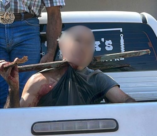 Trabalhador sofre acidente grave ao cair de árvore no Paraná
